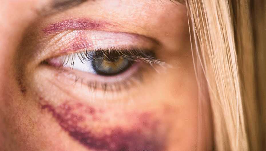 Comment savoir si on est victime de violence conjugale ?