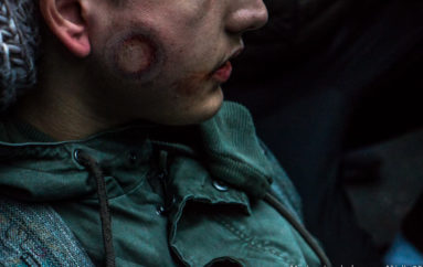 Dijon: Un adolescent reçoit un tir de flash-ball en plein visage